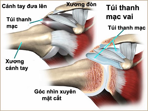 Viêm Túi Thanh Mạc Khớp Gối: Nguyên Nhân, Triệu Chứng và Cách Điều Trị Hiệu Quả